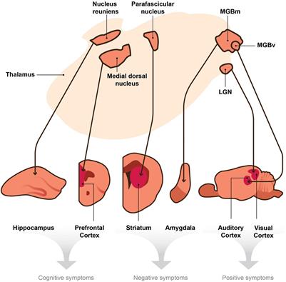 A Case for Thalamic Mechanisms of Schizophrenia: Perspective From Modeling 22q11.2 Deletion Syndrome